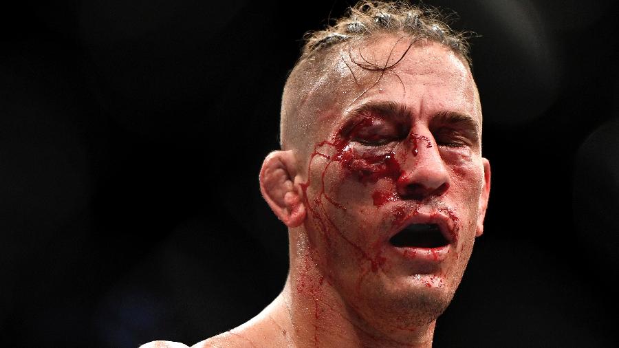 Niko Price sangra durante a luta contra Vicente Luque no UFC 249 - Douglas P. DeFelice/Getty Images