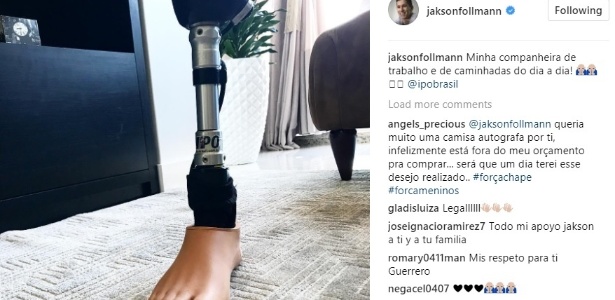 Chapecoense: Follmann bate bola com Neto e chama prótese de