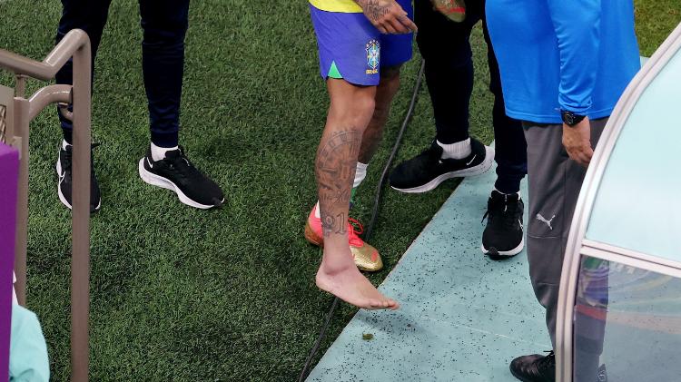 Neymar shows off a swollen ankle after the Brazil-Serbia match in the team's World Cup debut - REUTERS/Molly Darlington - REUTERS/Molly Darlington