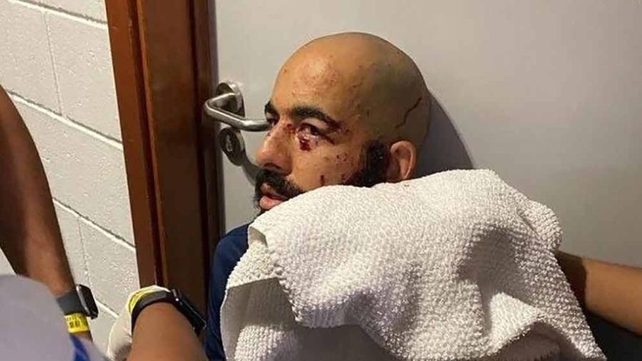 Danilo Fernandes, goleiro do Bahia, sofreu cortes no rosto após explosão de bomba no ônibus da equipe em 24/02/2022 - Reprodução/Twitter