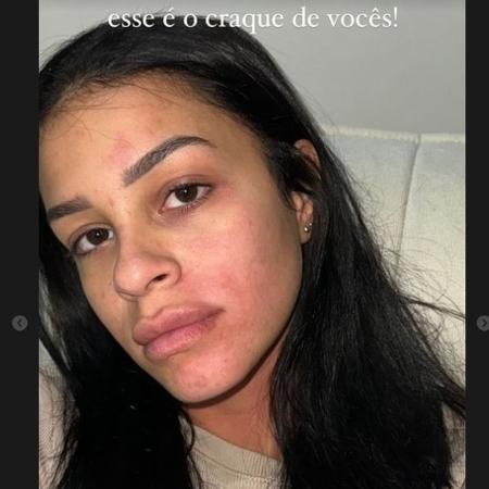 Isabella, ex-namorada de Kauê, do Botafogo, relatou agressão nas redes sociais - Reprodução