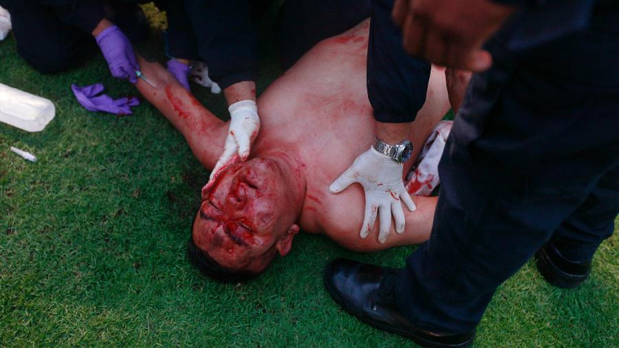 Torcedor do San Luis é ferido em confronto contra torcedores do Querétaro - Cesar Gomez/Jam Media/Getty Images