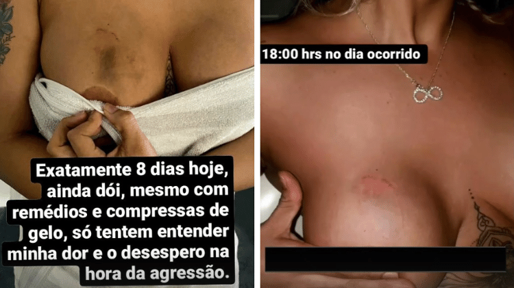 alcimara - Reprodução - Reprodução