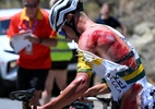 Ciclista medalhista olímpico sofre acidente e conclui prova ensanguentado