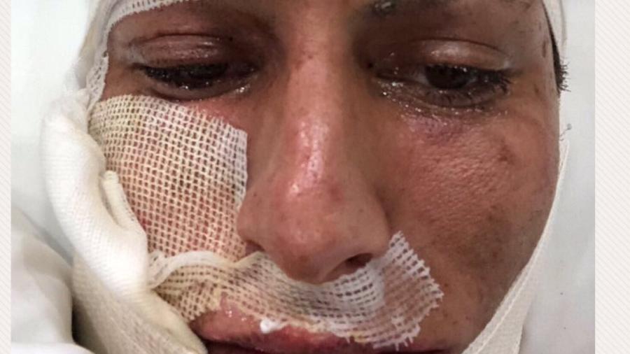 Jurgen Damm, jogador do Tigres e da seleção mexicana, sofreu queimaduras com fogos - reprodução