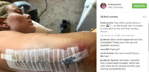 Lindsey Vonn publica foto mostrando cicatriz após acidente em treino  - Reprodução/Instagram 