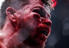 Ensanguentado, lenda do UFC fica com rosto desfigurado em derrota; veja
