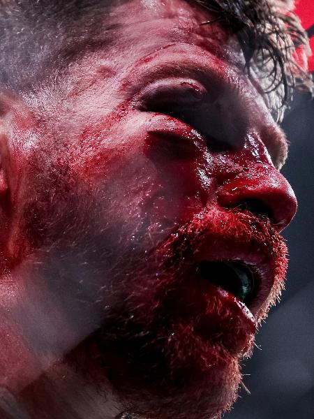 Jim Miller fica com rosto desfigurado na derrota para Bobby Green entre os leves no UFC 300