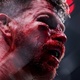Ensanguentado, lenda do UFC fica com rosto desfigurado em derrota; veja - Carmen Mandato/Getty Images
