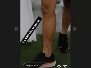 Presidente do São Paulo posta foto da perna de Pablo Maia após entrada no clássico