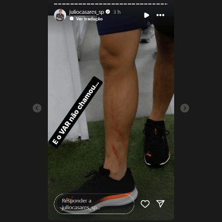 Julio Casares posta foto da perna de Pablo Maia após entrada no clássico