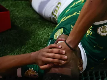 Estêvão tem lesão constatada em exame e desfalca Palmeiras contra Flamengo