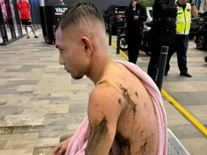 Jogador é atacado com ácido e passa por cirurgia na Malásia