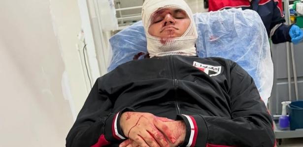 São Paulo deve ir além do protocolo, diz Arnaldo após acidente no Morumbis