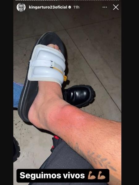 Vidal, Flamengo's midfielder, publishes a photo on a social network in which he shows his swollen ankle - Reproduction - Reproduction
