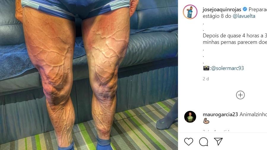 Ciclista espanhol mostra veias das pernas saltando após pedalar por 4h - Reprodução/Instagram