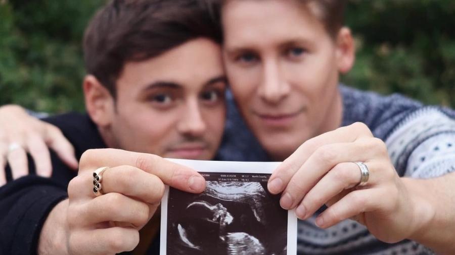 Tom Daley e o marido Dustin Lance Black mostram ultrassom de filho - Instagram/Reprodução