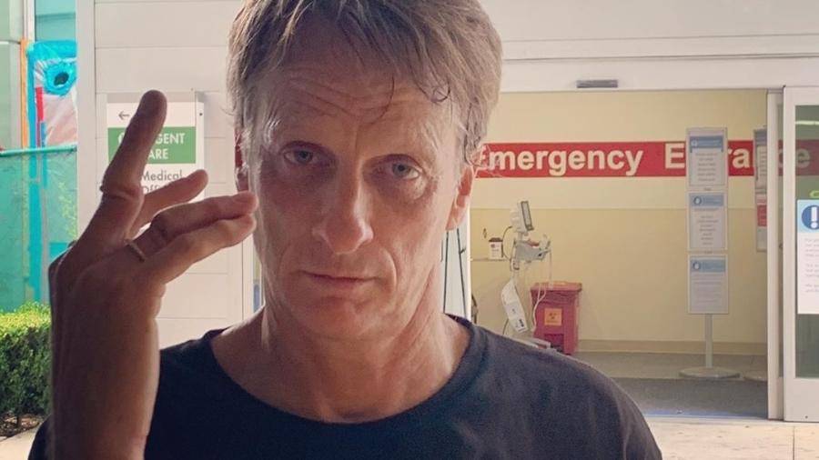 Tony Hawk mostra dedos deslocados após queda de skate - Reprodução/Instagram/@tonyhawk