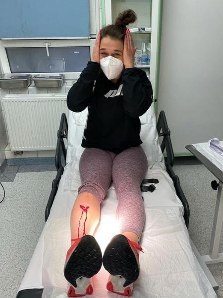 Joanna Jedrzejczyk exibe corte sofrido na canela durante treinamento - Reprodução