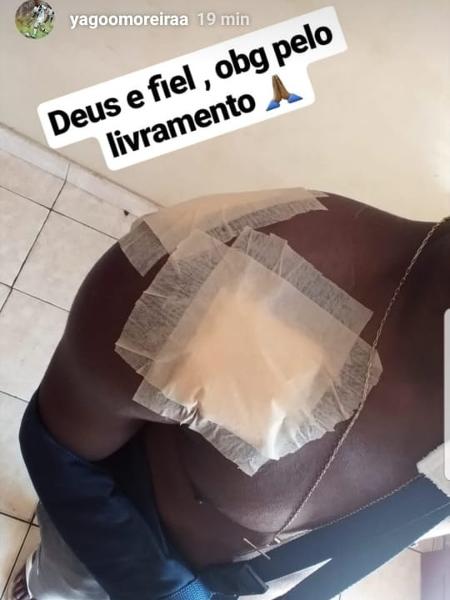 Atacante Yago, ex-Vasco, mostra curativos em postagem no Instagram após ser baleado no Espírito Santo - Reprodução / Instagram