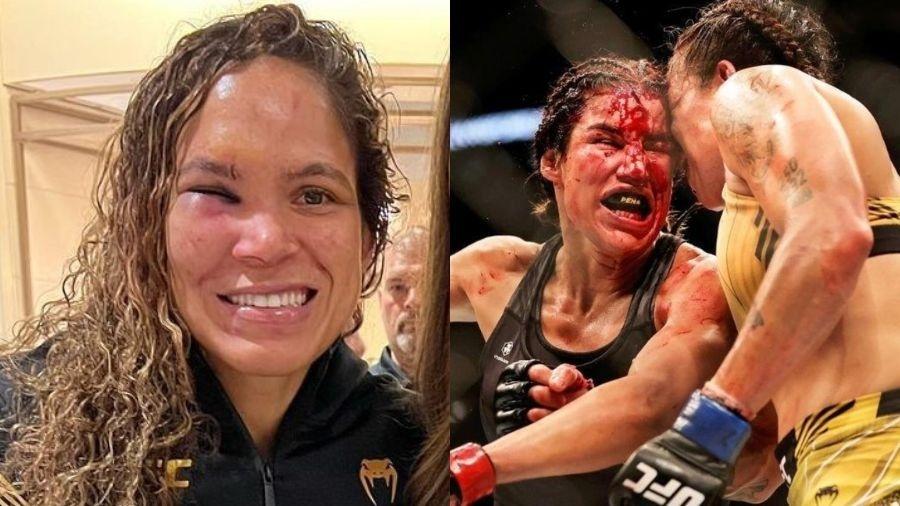 Especialistas analisam lesões de Amanda Nunes e Julianna Peña após duelo no UFC - Reprodução