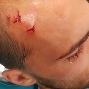 Bas Dost - Reprodução - Reprodução