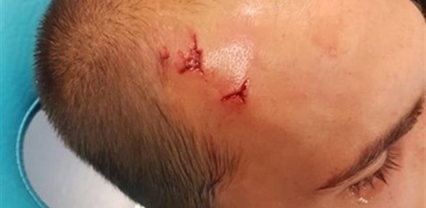 Ferimento na cabeça de Bas Dost após agressão de torcedores - Reprodução