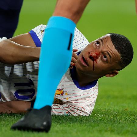 Mbappé machucou o nariz durante jogo entre França e Áustria, pela Eurocopa