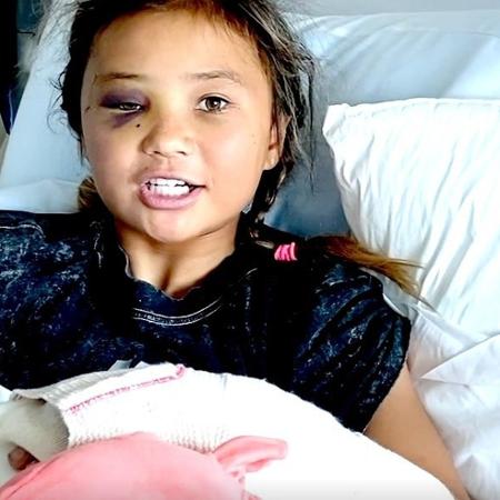 A skatista britânica Sky Brown se recupera no hospital após uma grave queda - Reprodução/Instagram
