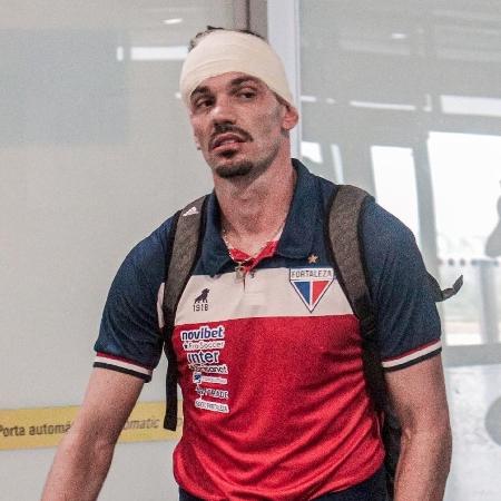 João Ricardo, goleiro do Fortaleza, após ser ferido durante ataque ao ônibus do clube