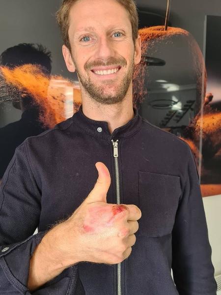 Grosjean mostra a mão com queimaduras pela primeira vez após acidente - Reprodução