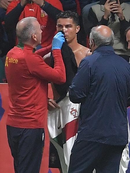 Cristiano Ronaldo recebe atendimento médico após se chocar com o goleiro Vaclik - MICHAL CIZEK/AFP