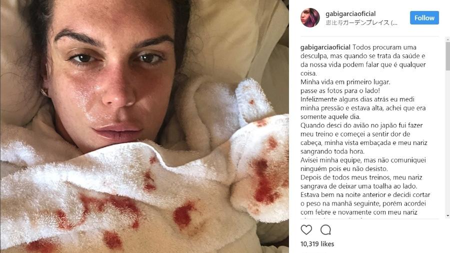 Gabi Garcia publicou foto no Instagram mostrando problemas de saúde - Reprodução Instagram