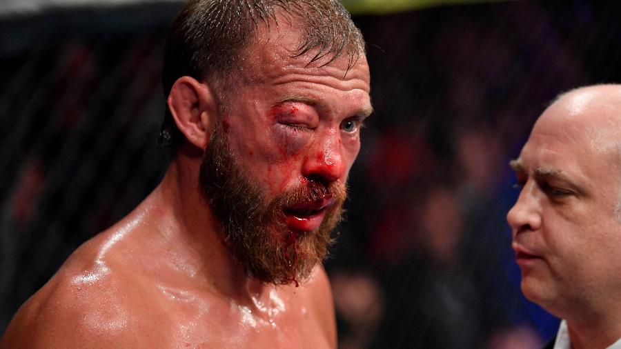 Donald Cerrone ficou com olho inchado durante luta no UFC 238 - Jeff Bottari/Zuffa LLC/Zuffa LLC via Getty Images