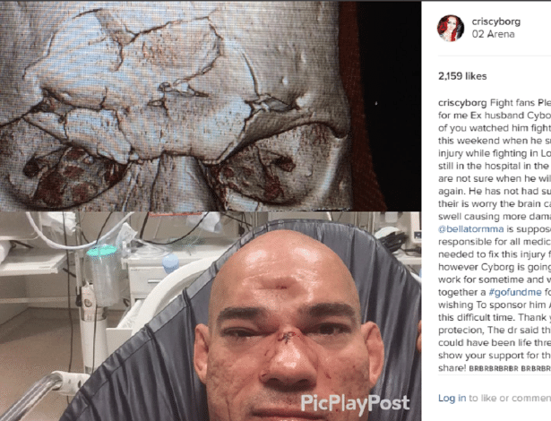 Cris Cyborg postou pedidos de apoio ao ex-marido no Instagram - Reprodução/Instagram