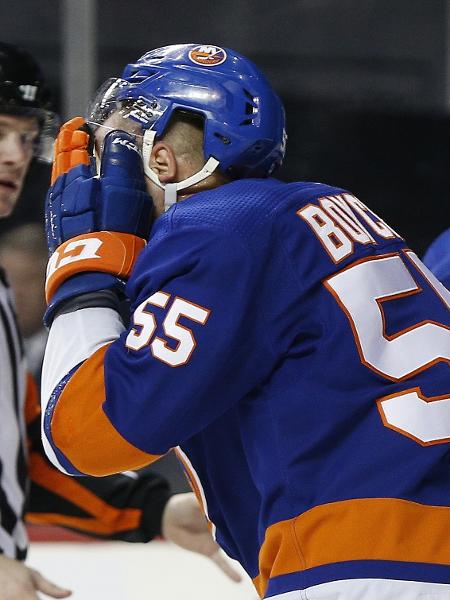 Jogador da NHL leva 90 pontos no rosto após ser atingido por patim
