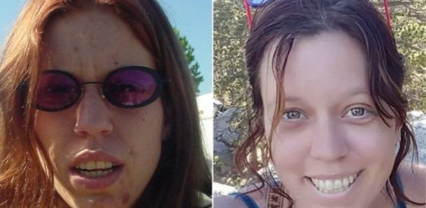 Americana se destacou na internet após mostrar fotos de antes e depois de recuperação de vício em drogas - Kristy Ehrlich