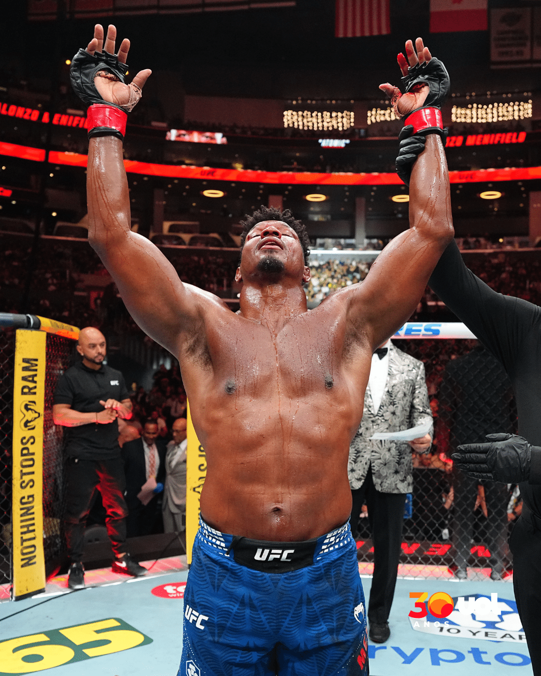 Ufc Flash Americano exibe fratura exposta após vitória heroica no UFC 331; veja
