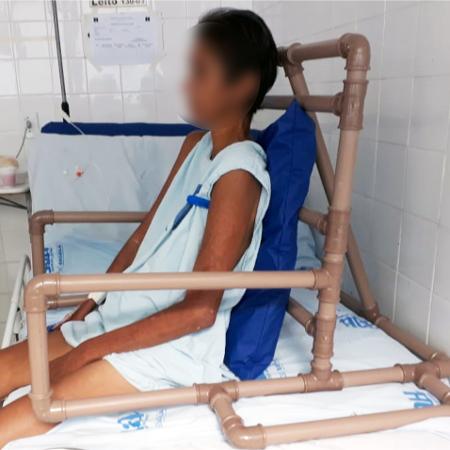 Órteses de tubos de PVC - Ana Paula Tenório de Lima/Divulgação - Ana Paula Tenório de Lima/Divulgação