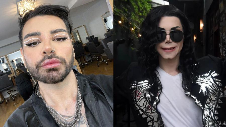 Fãs de Ricky Martin e Michael Jackson realizaram procedimentos para se parecerem com os ídolos - Reprodução/Instagram