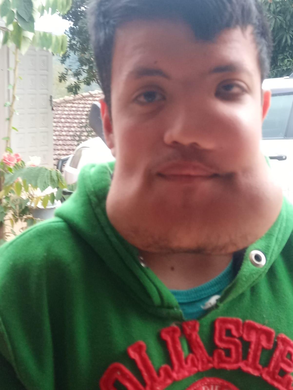 Marlon André Krenkel tem querubismo - Arquivo pessoal