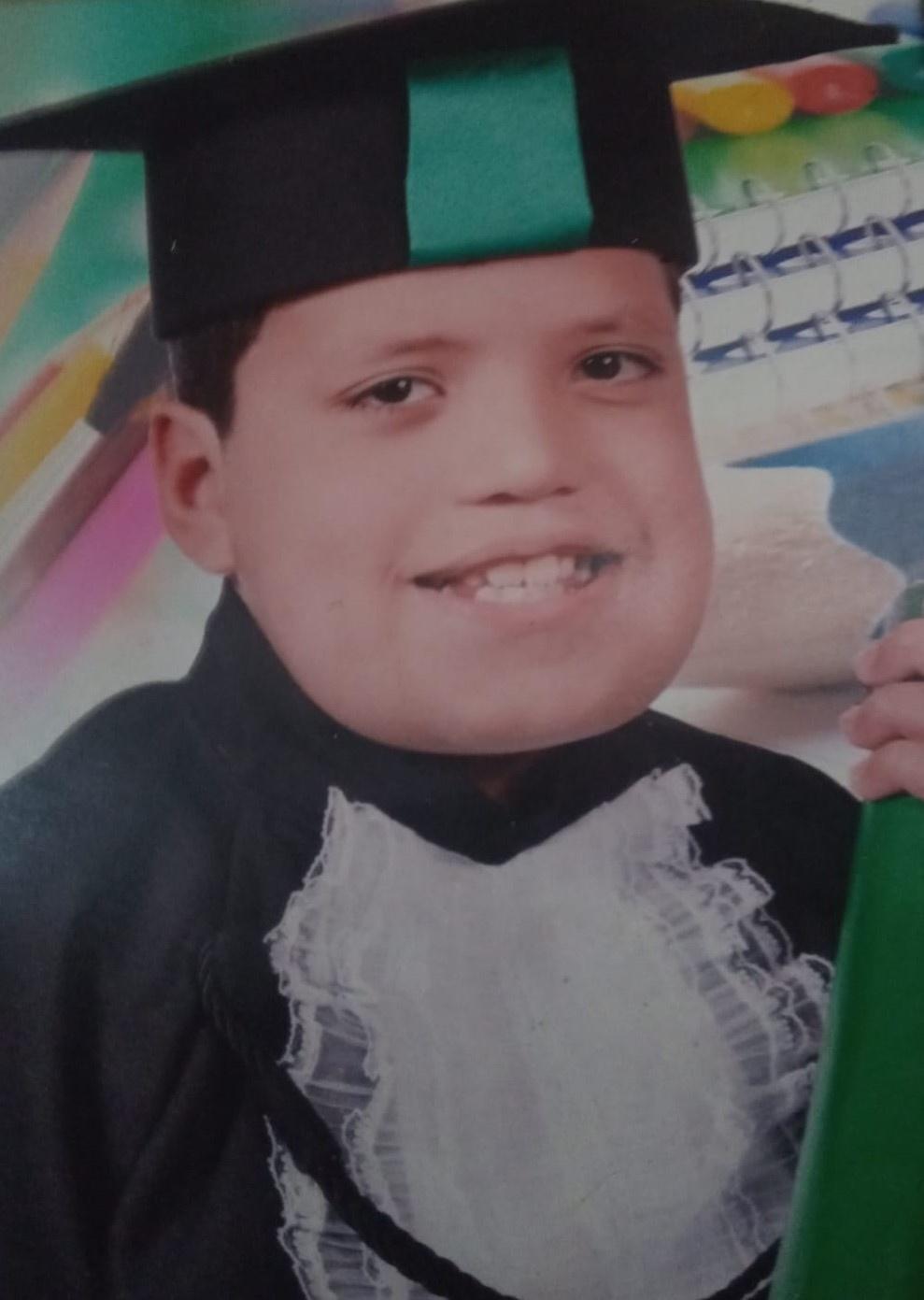 Marlon André Krenkel tem querubismo - Arquivo pessoal