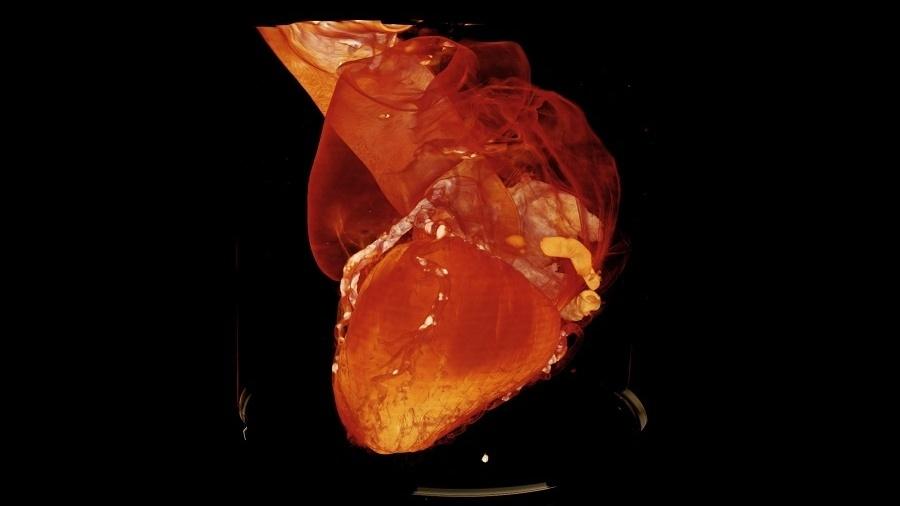 Imagem de um coração intacto de uma mulher de 94 anos realizada pelo HiP-CT - Divulgação