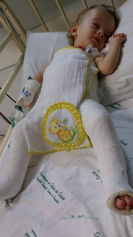 Bebê de jovem com 'ossos de vidro' nasce com a mesma doença no Acre e já  teve 13 fraturas pelo corpo, Acre