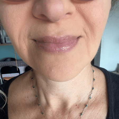 Com o Epidrat Hyalu, da Mantecorp Com o Epidrat Hyalu, da Mantecorp