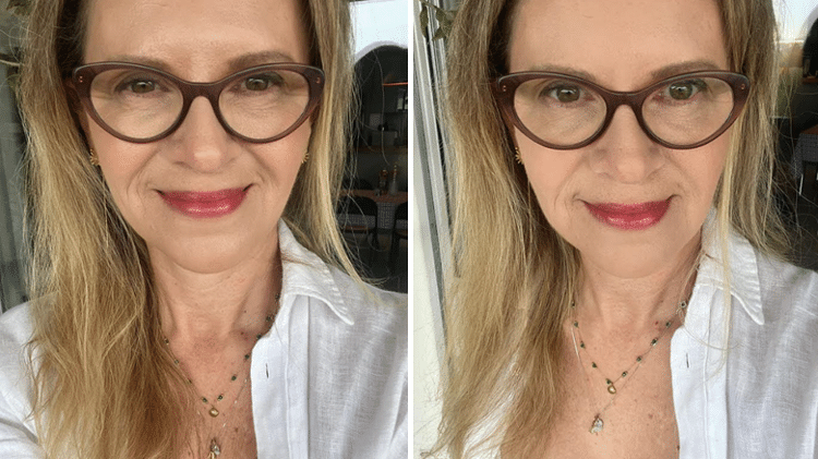 Antes e depois da aplicação do Invisible Touch