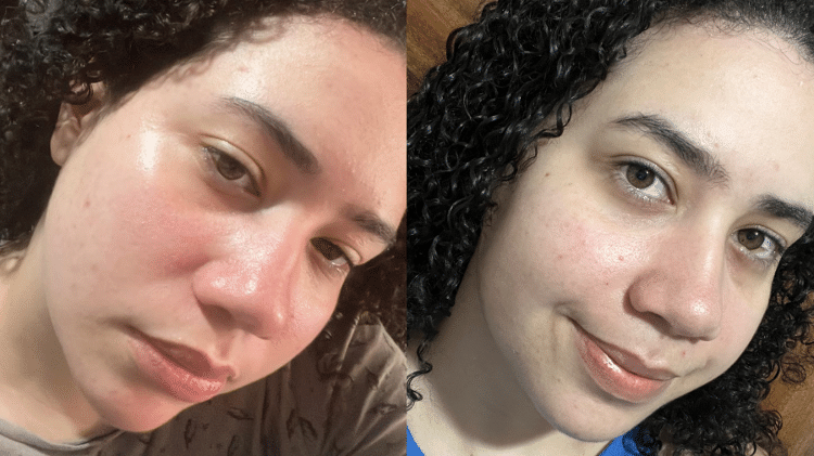 Antes (esq.) e depois (dir.) de usar o protetor solar da Sallve Antes (esq.) e depois (dir.) de usar o protetor solar da Sallve