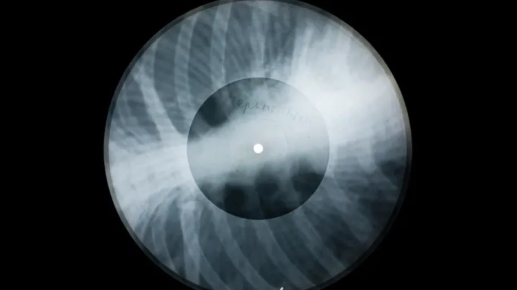Placa de raio-x em formato de disco - Reprodução - Reprodução