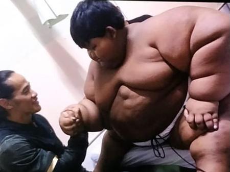 Lembra dele? Veja como está o menino 'mais gordo do mundo' após perder 110kg  - Diario ao Vivo