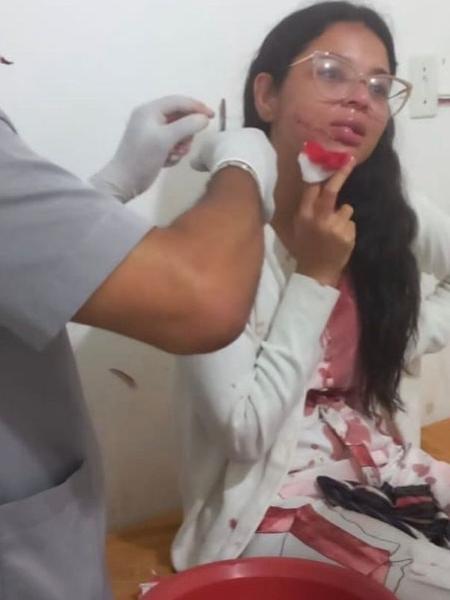 A estudante Stefani Firmo é atendida em hospital após ter o rosto cortado enquanto dormia numa viagem de ônibus de Recife a Salvador